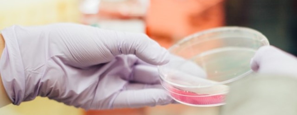 Herziene richtlijn diarree in de palliatieve fase gepubliceerd