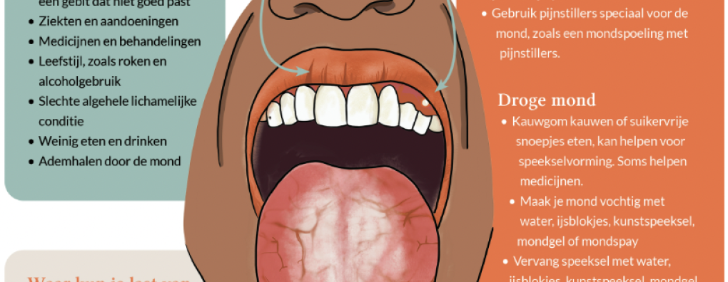 Nieuwe Carend Infographic: Mondklachten