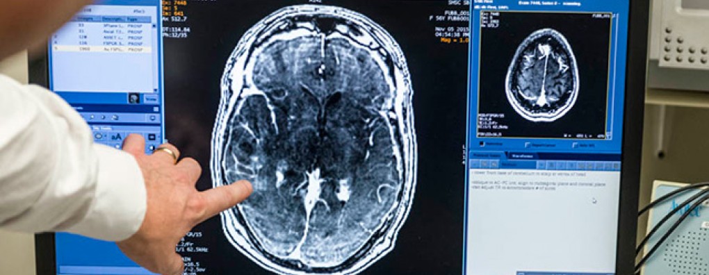 Webinar 'Palliatieve zorg bij hersentumoren' op 29 november