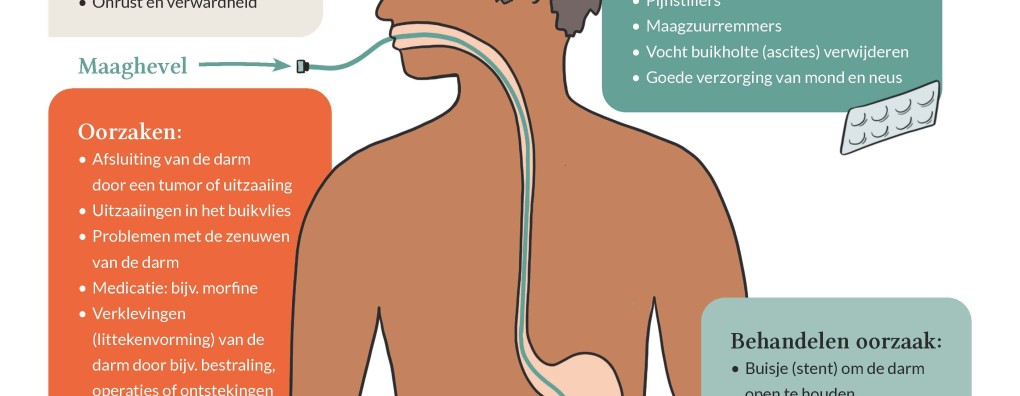 Carend Infographic: Ileus
